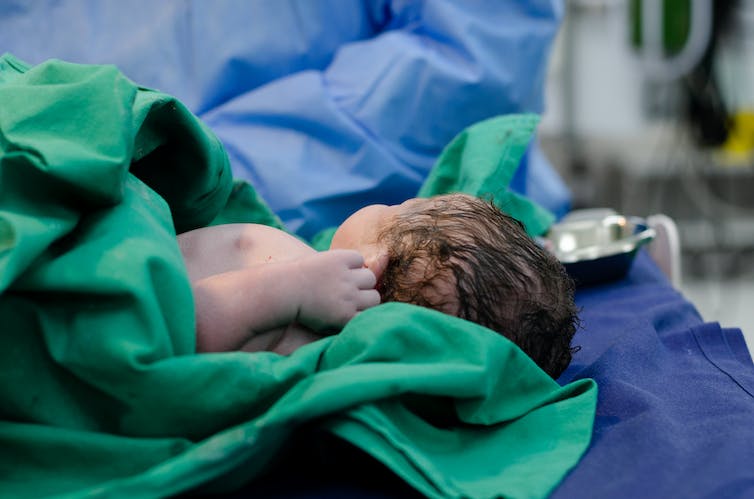 Bébé étant nettoyé après la naissance
