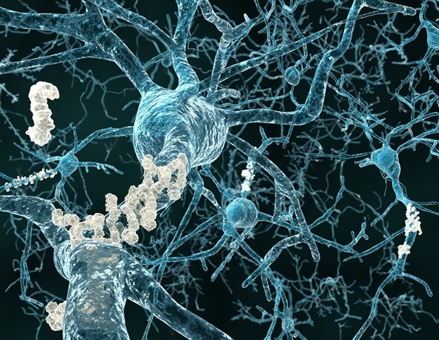 Des scientifiques découvrent un moyen de « pirater » l’horloge interne des neurones pour accélérer le développement des cellules cérébrales