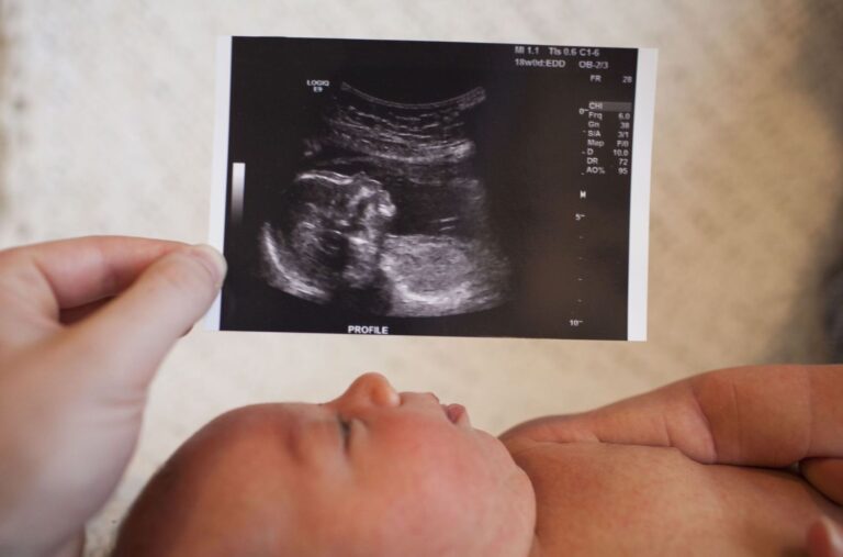 Échographie bébé garçon : à quoi s&rsquo;attendre