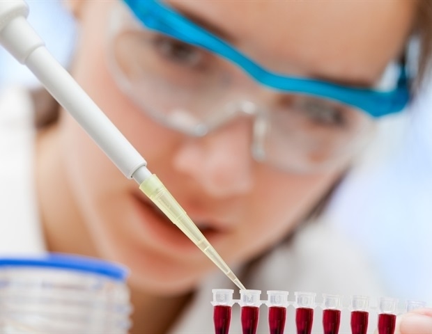 Répéter le test PlGF pour la pré-éclampsie n’est pas bénéfique, selon la recherche