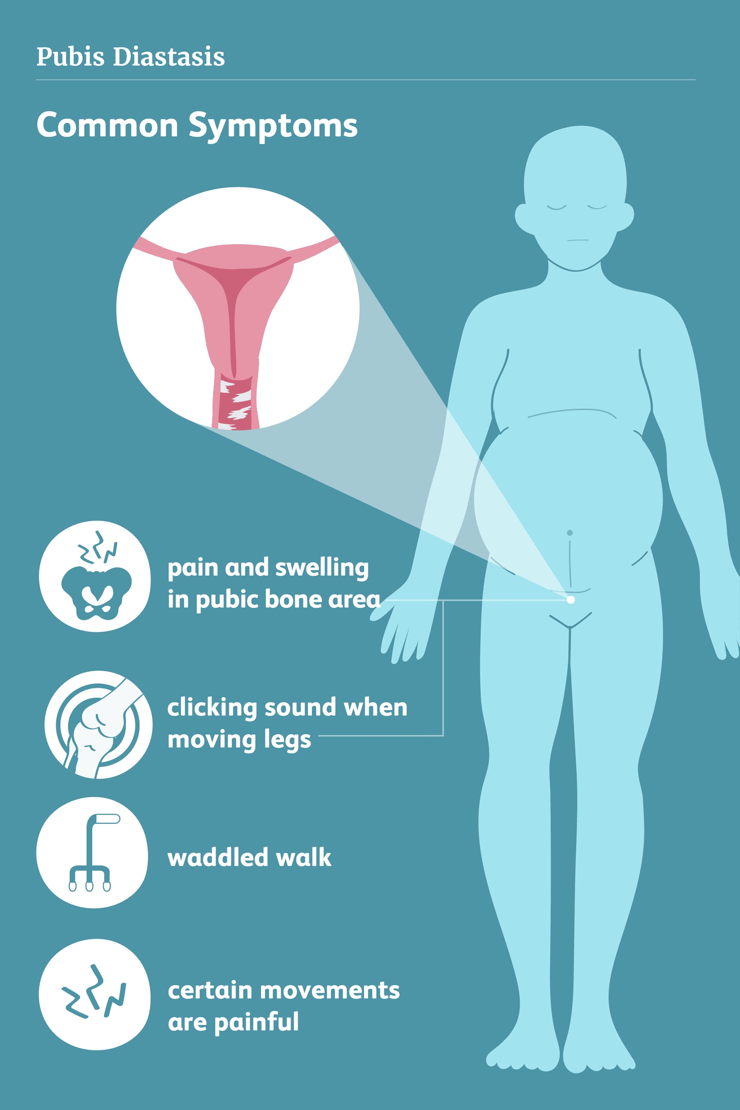 Douleur aux os pubiens pendant la grossesse : causes, diagnostic et traitement