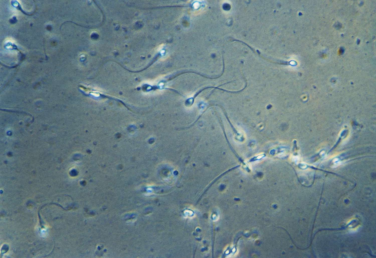 Motilité des spermatozoïdes : définition, analyse et plus encore